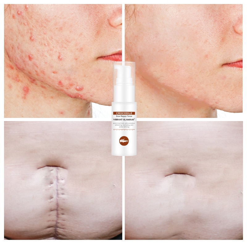 crocodile face toner