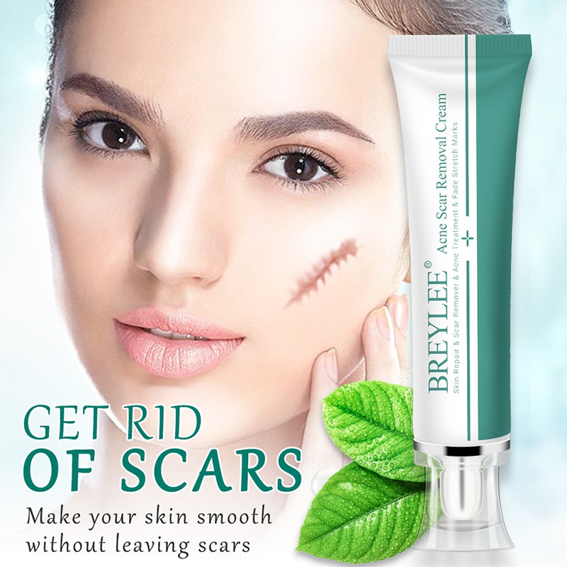 cream to get rid of scars