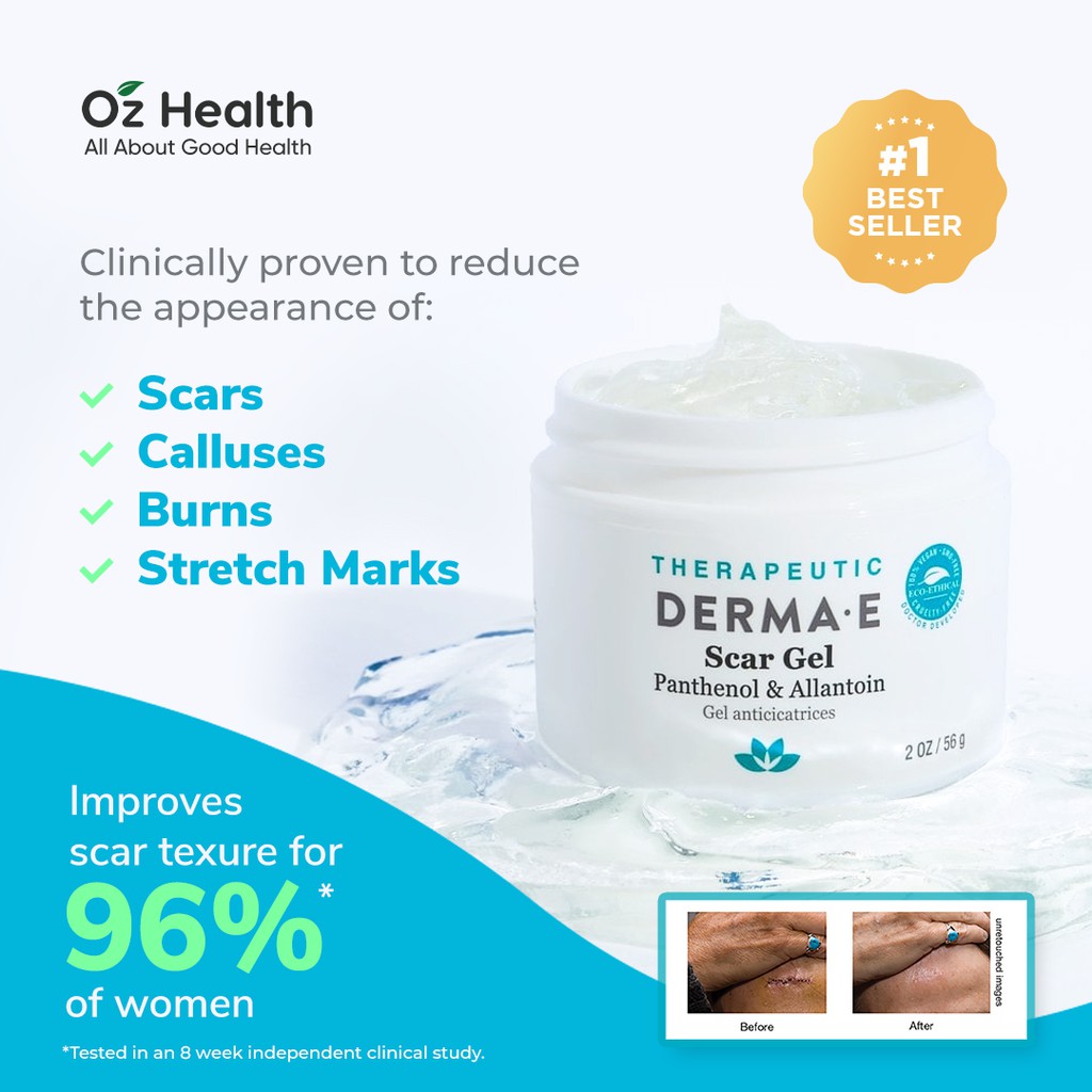 Derma E Scar Gel 56g - Shopee Singapore