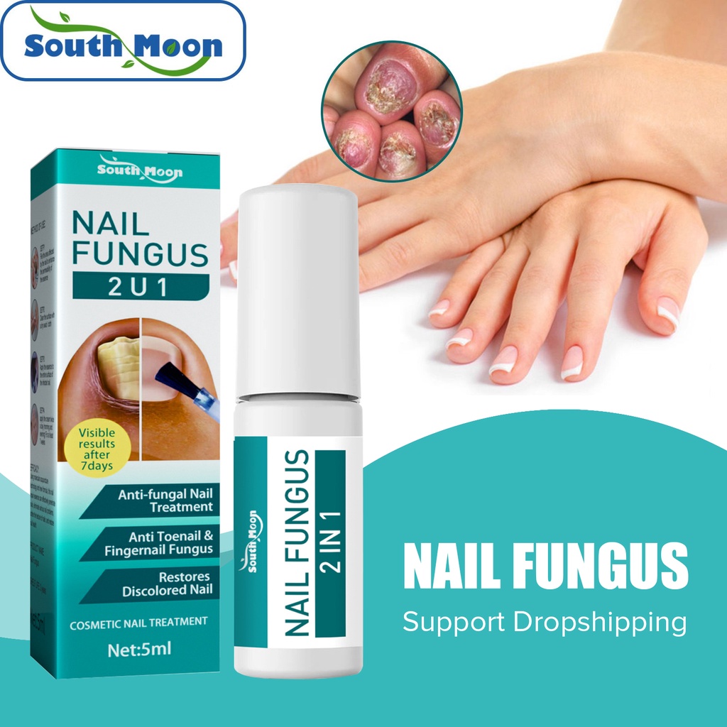 South Moon 5ml Nail Repair Liquid Effective Treatment Onychomycosis ...