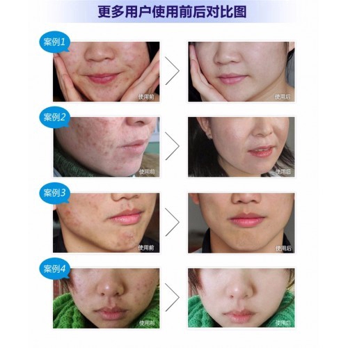 serum bioaqua pure skin