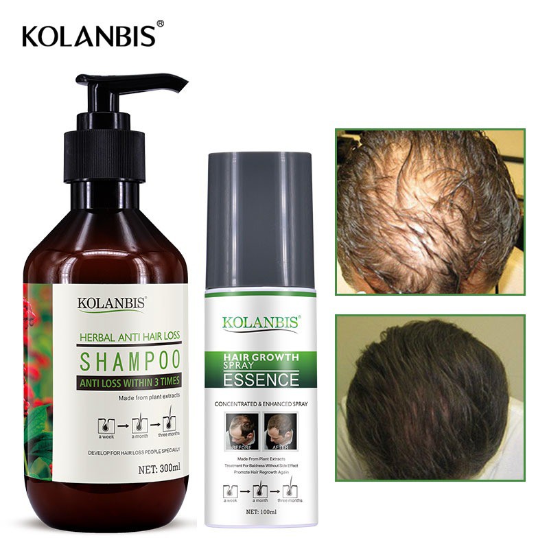 Hair Growth Tonic Essence Spray Shampoo Reduce Hair Fall Thinning Hair Loss  Treatment Hair Follicle Therapy Hair Care | Shopee Singapore