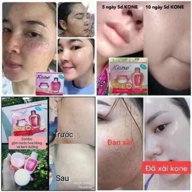 skin care kone