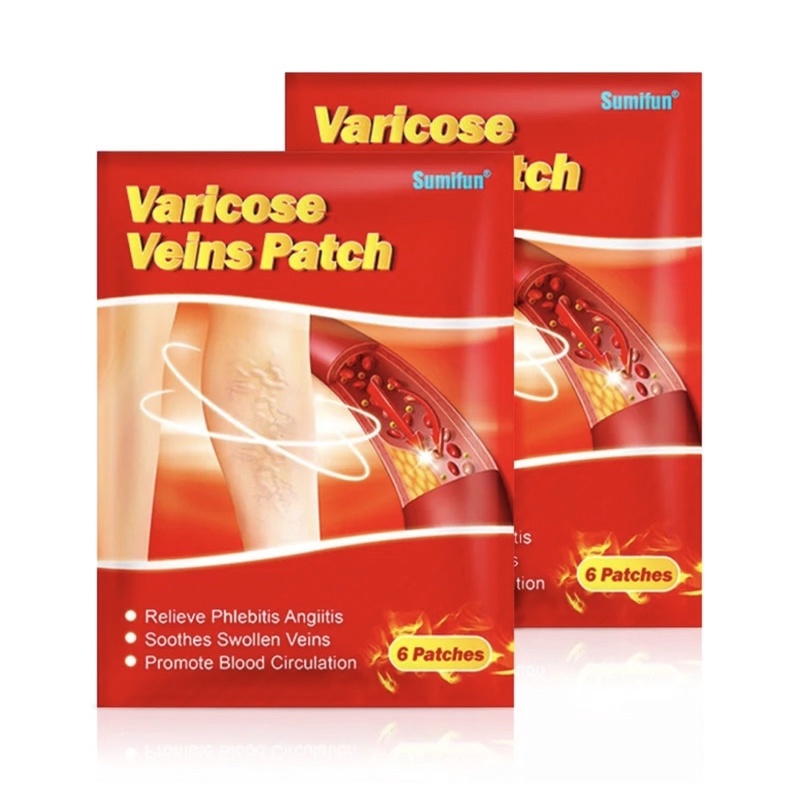 Varicose Veins Patch Treatment | Shopee Singapore