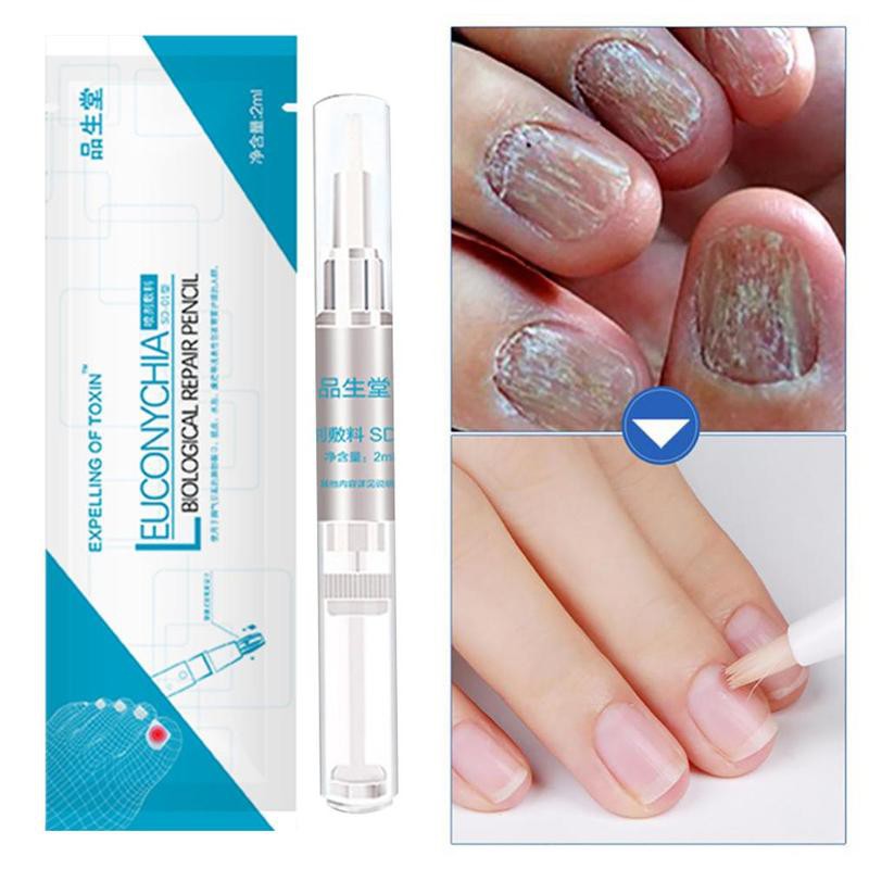 Nail Fungus Treatment Nail Oil Pen Anti Fungal Nail Infection Cuticle Remover Liquid Nail Growth Skin Care Shopee Singapore