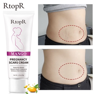 RtopR Mango Remove Pregnancy Scars Acne Cream Stretch Marks Treatment Maternity Repair Anti-Aging Anti-Winkles Firming Body Creams #0