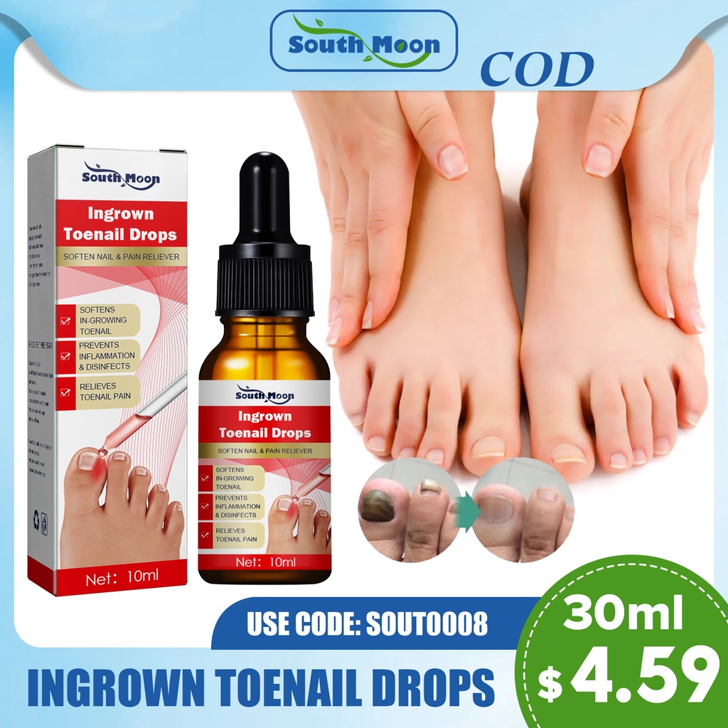 [South Moon] 30ml Ingrown Toenails Drops Glue-free Toenail Essence Oil ...