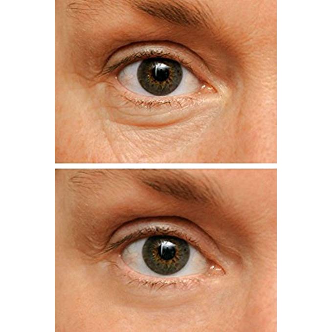 wunderlift 60 second