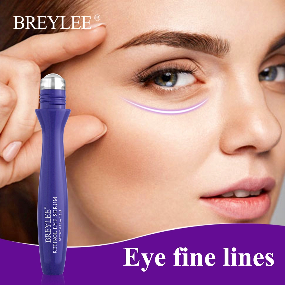 fine lines eyes