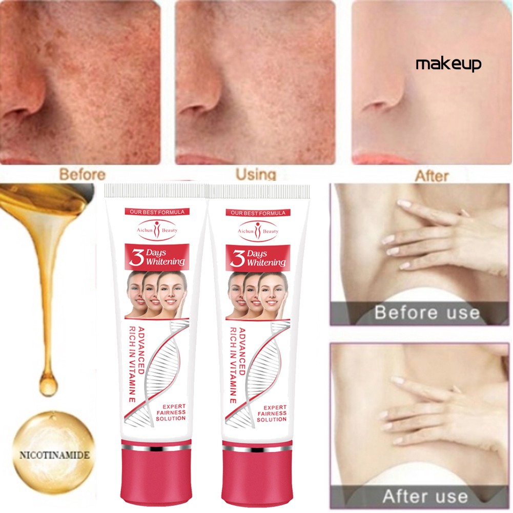 best cream for removing dark spots