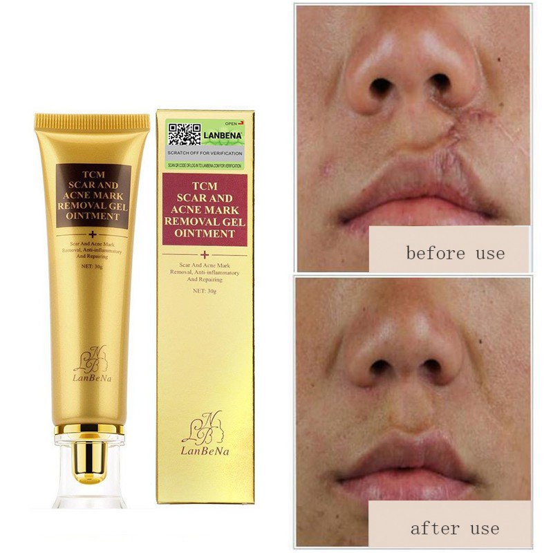 lanbena scar cream