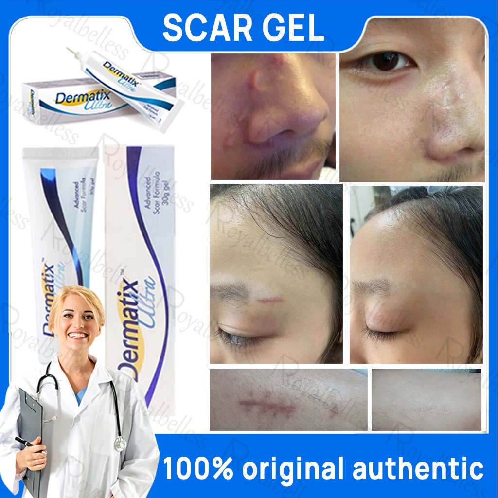 Dermatix Effective Scar Removal Cream Scar Gel Old Scar Acne Scar