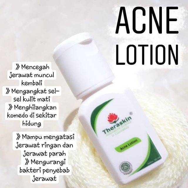 acne lotion