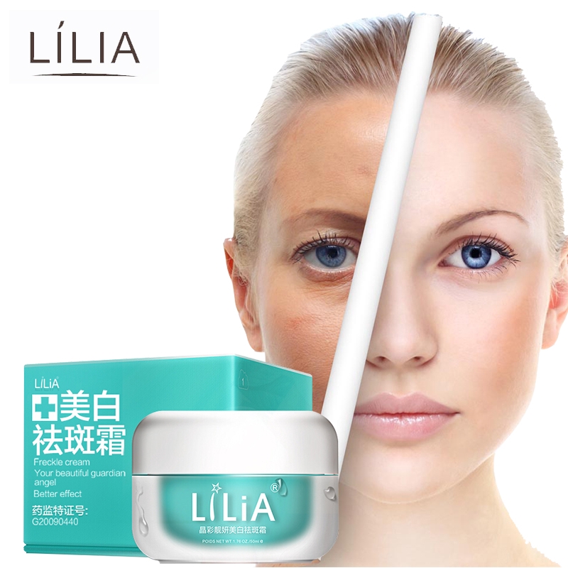 melanin pigment removal cream