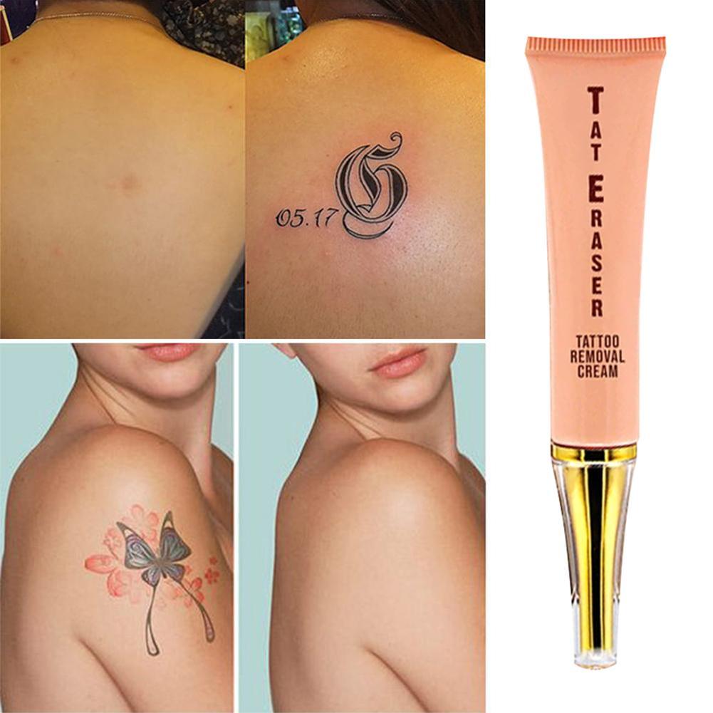 13g Permanent Tattoo Removal Cream Tattoo Print Cleaning Cream Applicable To Most Part Of Body Shopee Singapore