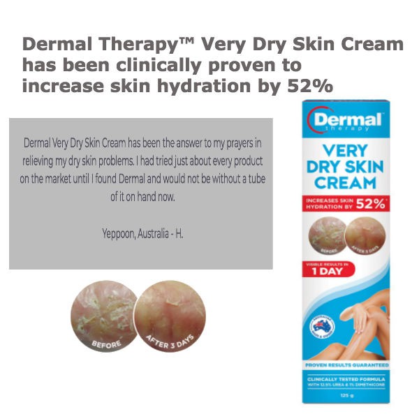dermal therapy face & eyelid eczema cream