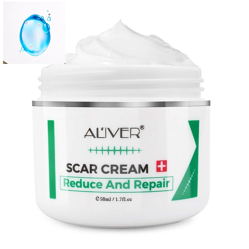 [In stock]Aliver 50Ml Scar Repair Cream for Keloid,C-Section ...