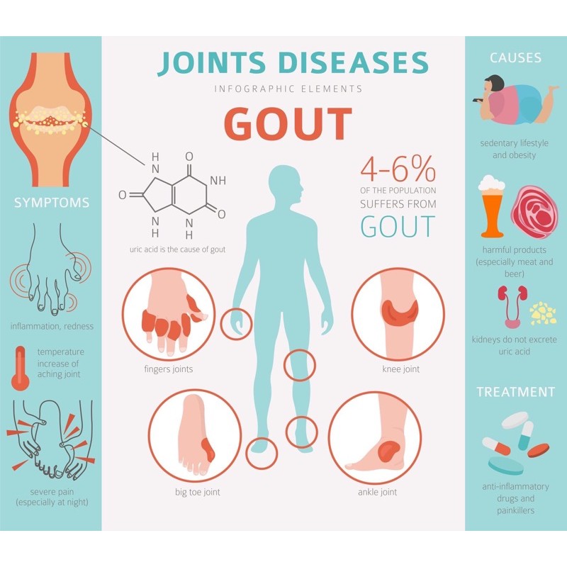Shop Malaysia Thailand Traditional Urine Acid Herbal Medicine Thai Uric Acid Gout Powder Shopee Singapore