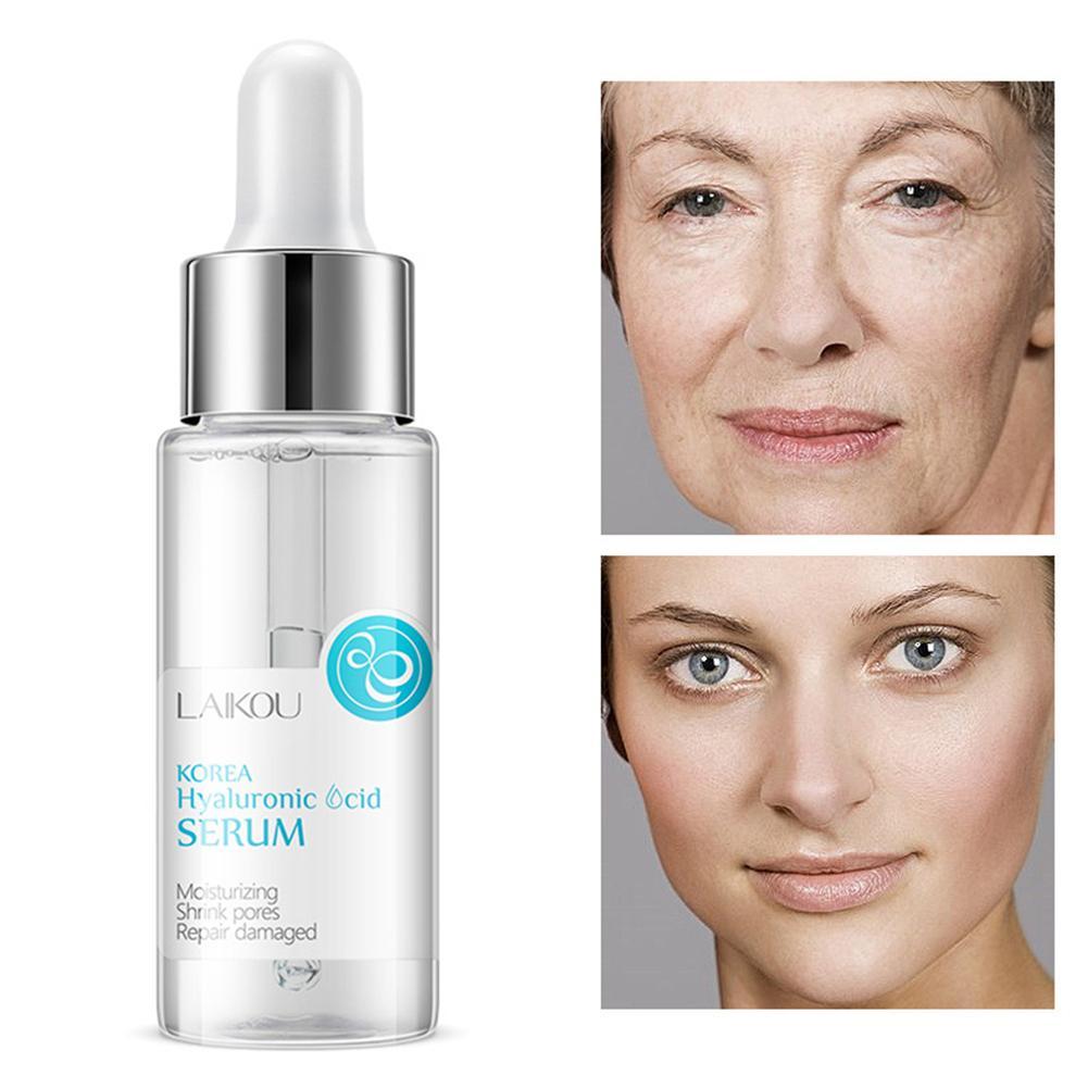 sodium hyaluronate moisturizer