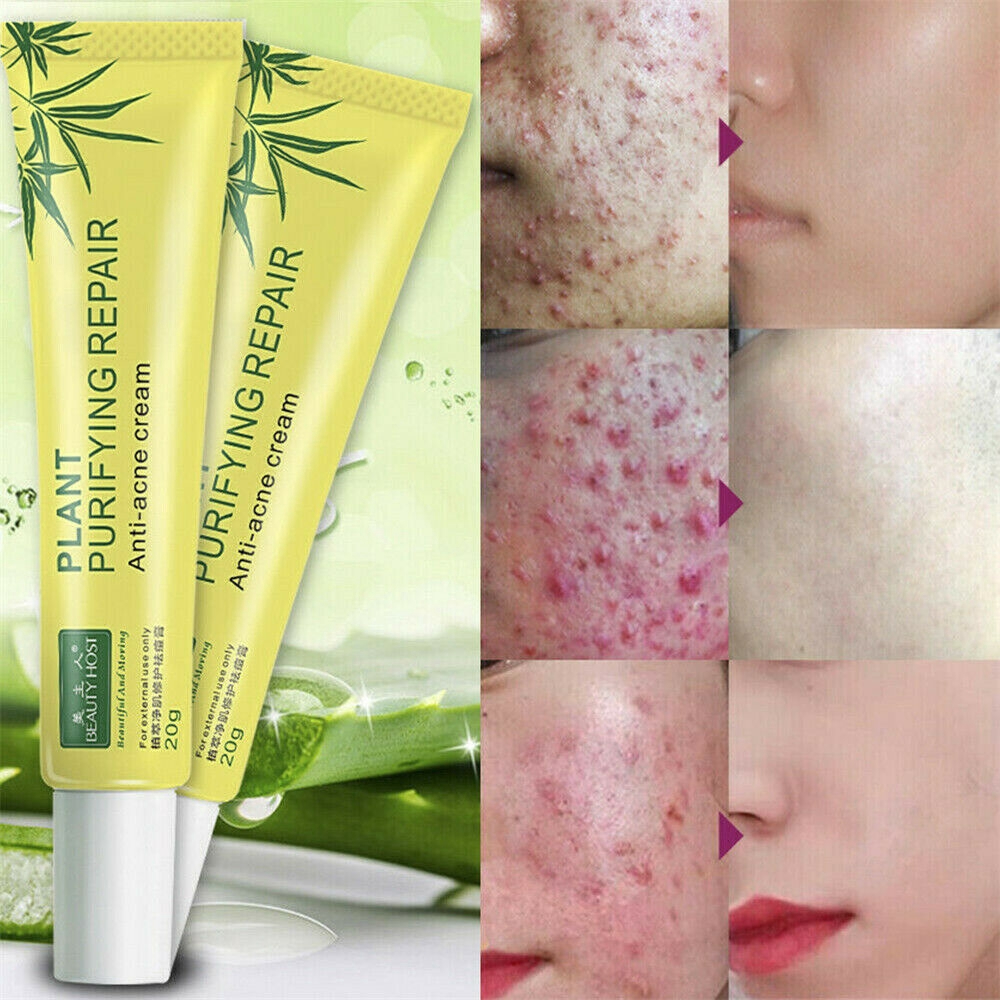 best scar removal cream 2020