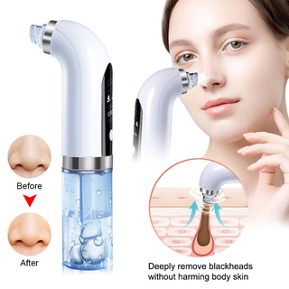2022 Upgrade Blackhead Remover Vacuum Electric Nose Face Pore Deep Cleaning Skin Care with Blue Light Hydrating Function