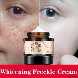 Powerful whitening freckle cream plant face cream remove freckles and dark spots 30g