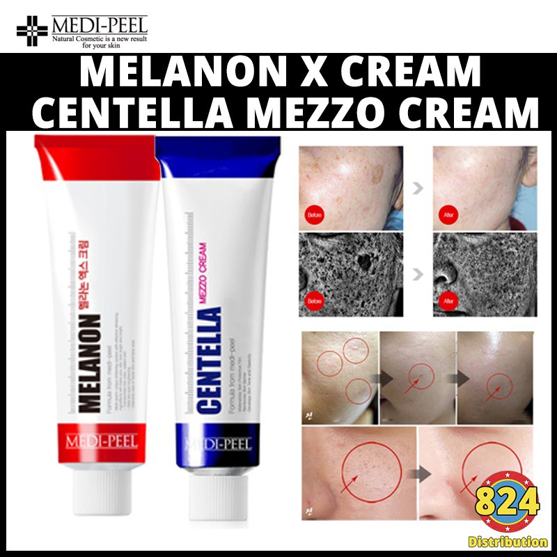 Medi Peel Melanon X Cream 30ml Or Mezzo Cream 30ml Real Whitening And Calming Made In Korea Shipping From Korea Shopee Singapore
