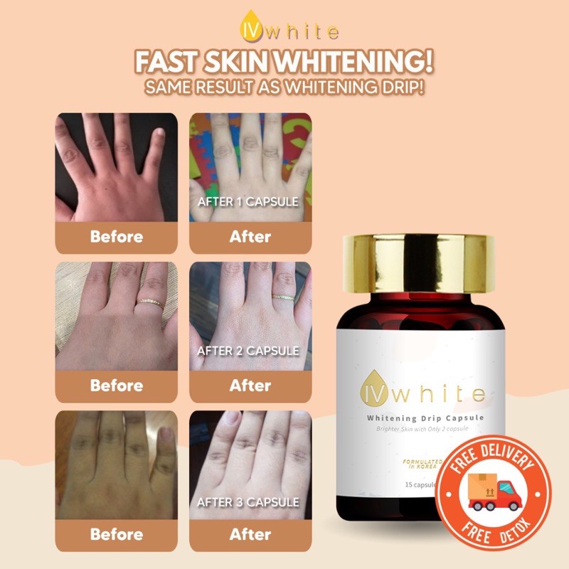 Ivwhite Korea Whitening Drip Capsule Supplement Highly Effective Glowing Skin Booster Shopee Singapore
