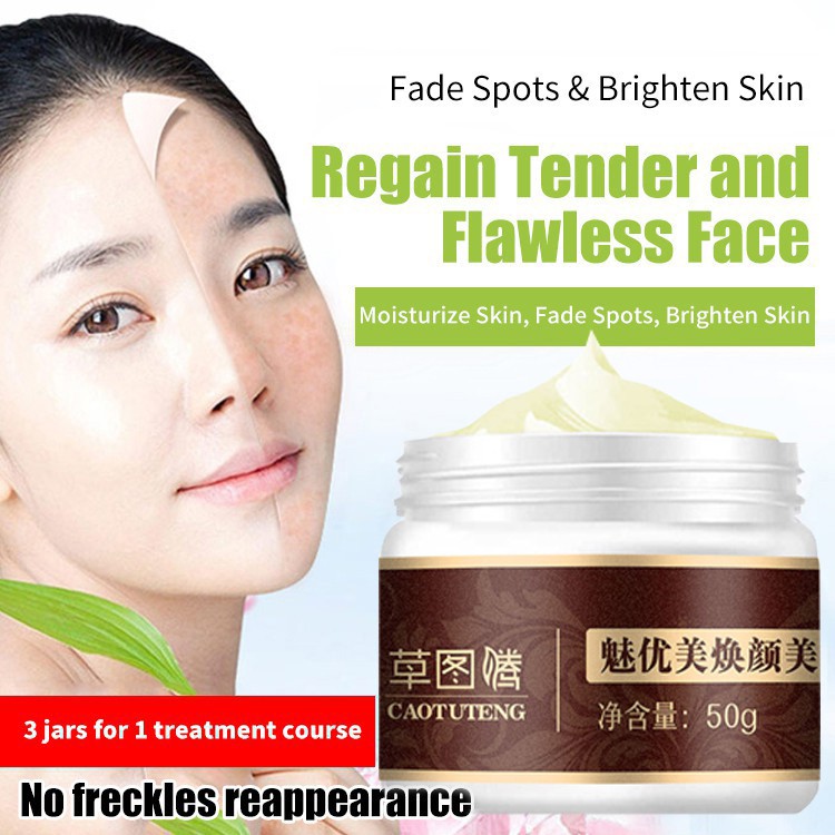 freckles treatment cream