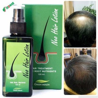 SG SELLER❤️Thailand NEO HAIR LOTION Original Hair Treatment Solution 120ml