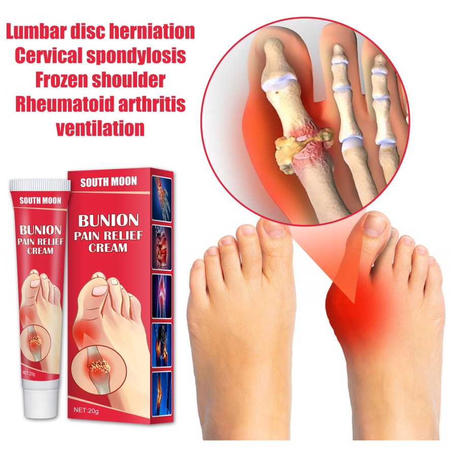 LLKQQ 20g Bunion Gout Pain Relief Ointment Toe Joint Valgus Corrector