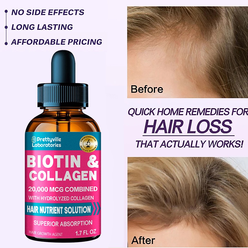 Hair growth essential oil and hair care products can effectively prevent hair  loss and promote rapid hair growth | Shopee Singapore