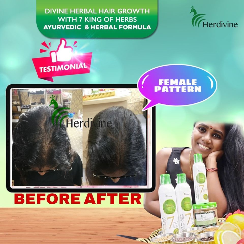 🔥TERLAJAK LARIS-Herdivine -LADIES BASIC Anti Hair fall SHAMPOO set🔥  Shampoo + Conditoner + Oil 250ML | Shopee Singapore