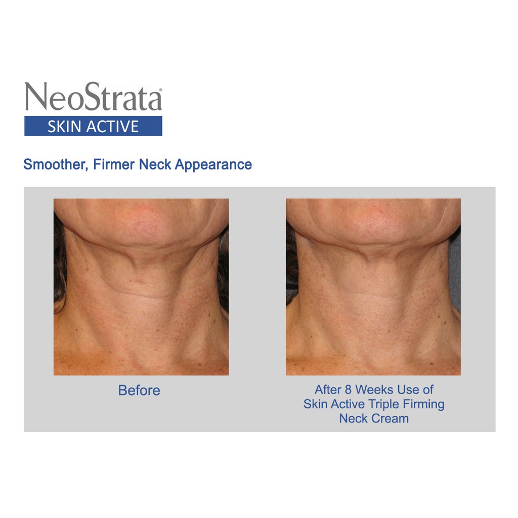 neostrata neck