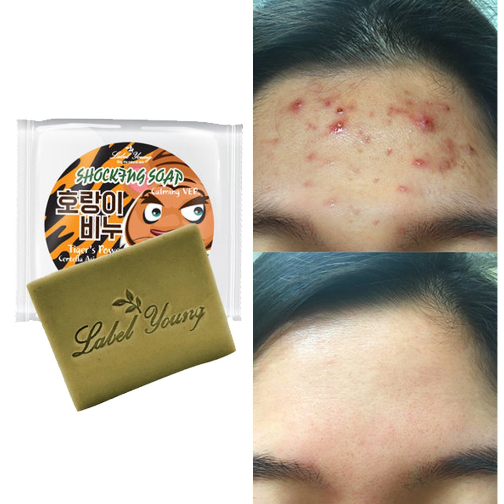 oily soap care