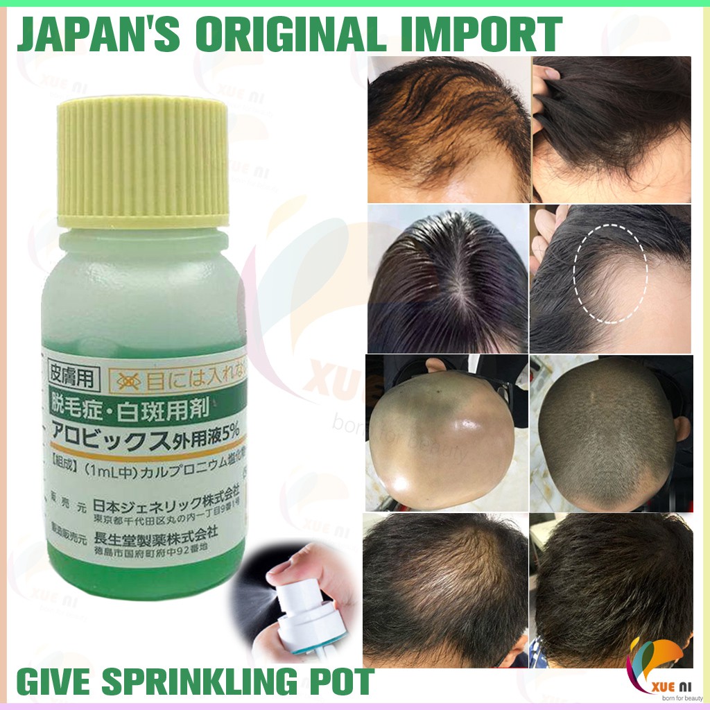 Japan's JG 生发水 Hair Growth Tonic 【现货 READY STOCK】 Shopee Singapore