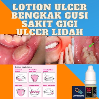 Oral aid lotion