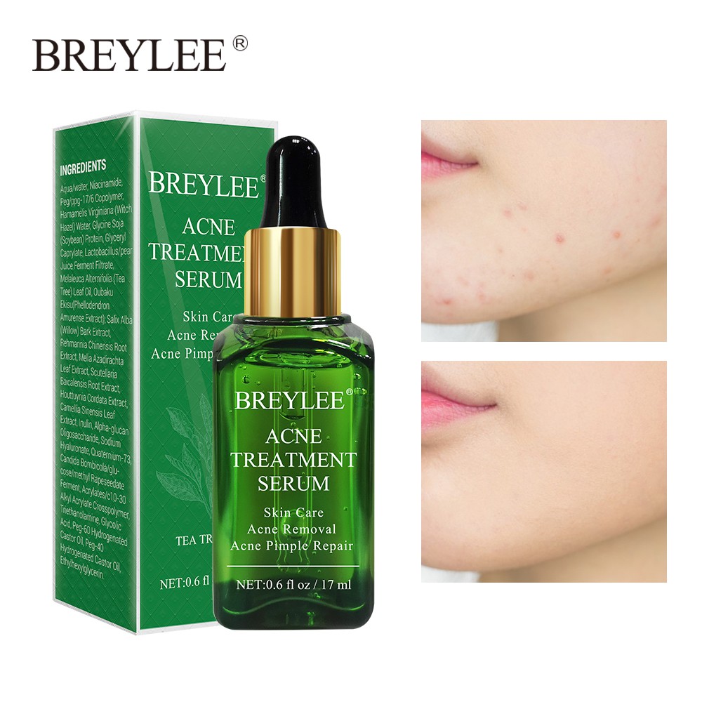 breylee acne treatment serum