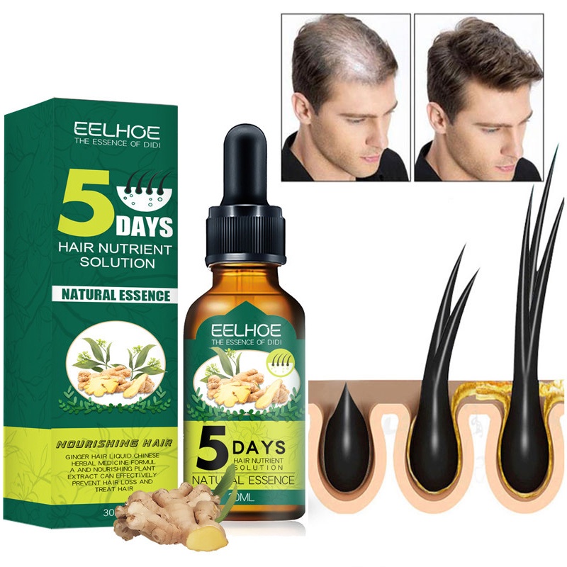EELHOE 5 Days Ginger Hair Growth Essential Oil Products Original Anti 