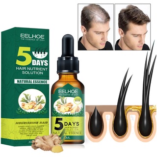 EELHOE 5 Days Ginger Hair Growth Essential Oil Products Original Anti ...