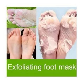 baby feet skin peel