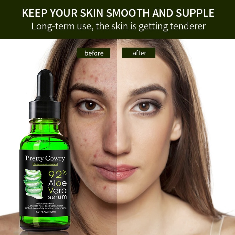 serums acne