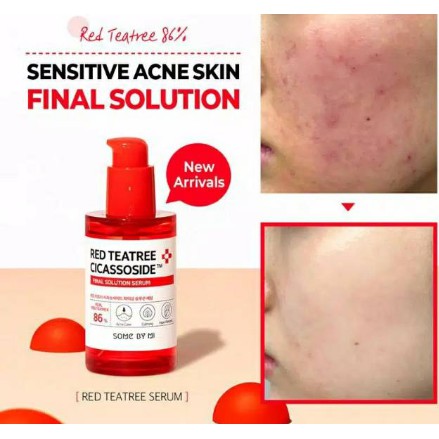 some by mi sensitive skin