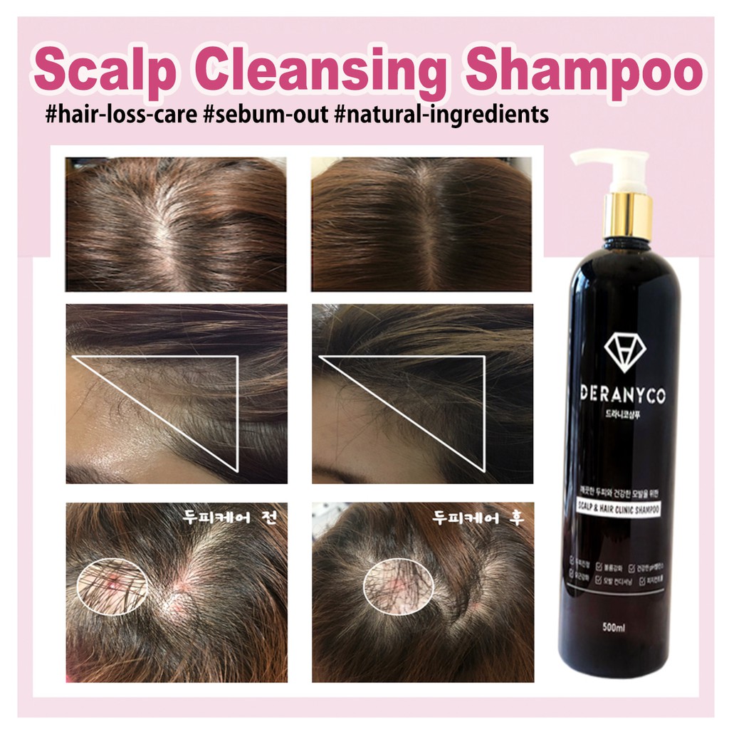 Korea Hair Loss Care, Hair Root Strenghtening, Scalp Cleansing Deranyco