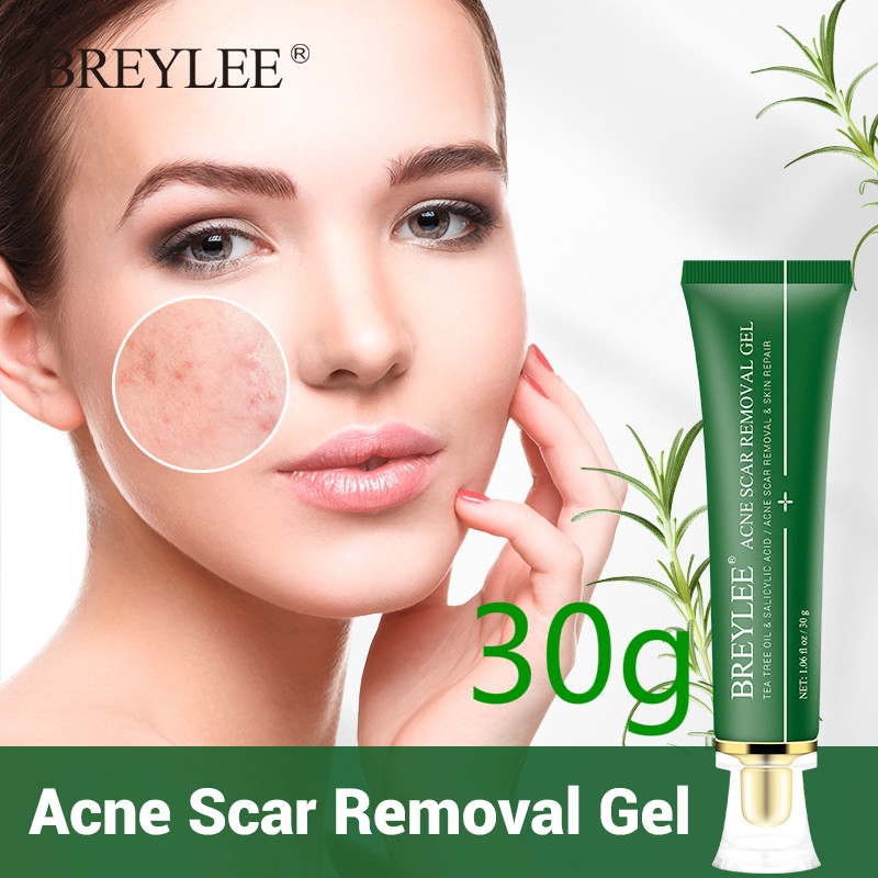 serum to prevent acne