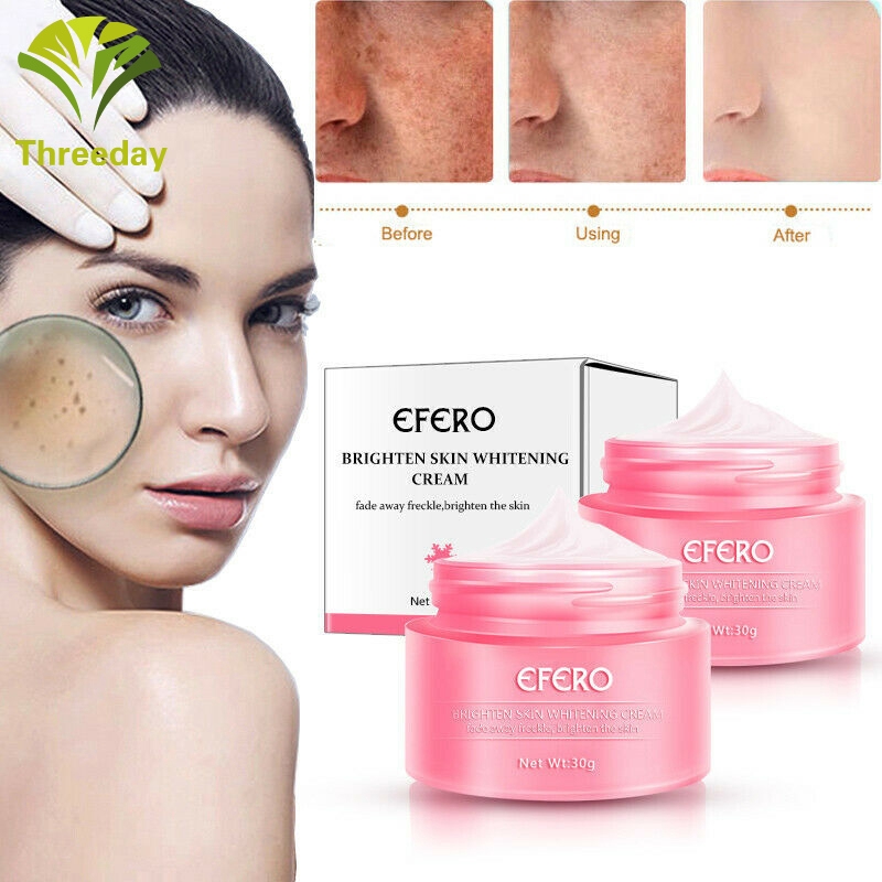 cream to remove pigmentation on face