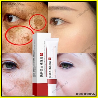 [ready stock] Effective Freckle Cream Remove Dark Spots Witening Cream Fade Acne Scars Melasma Anti-Aging Skin Lightening 20g