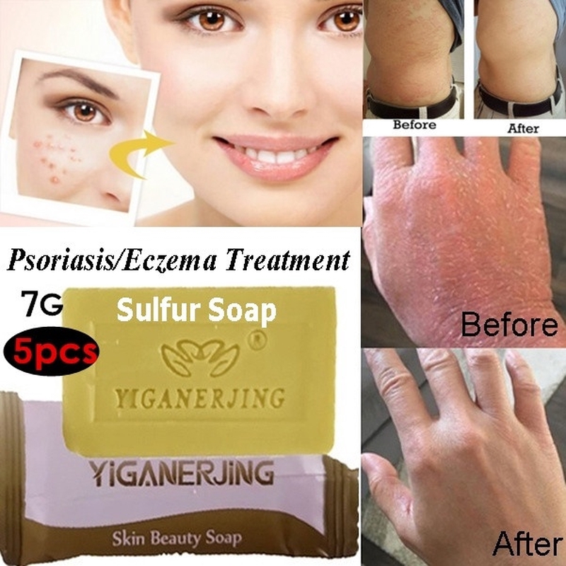 Soaps For Eczema ubicaciondepersonas.cdmx.gob.mx