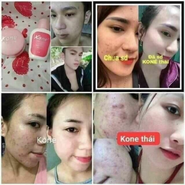 skin care kone
