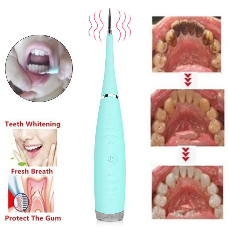 sonic ultrasonic tooth cleaner